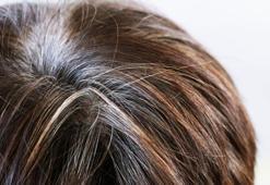 ‘Genetiktir’ deyip geçmeyin… Saçlarınız beyazlıyorsa vücudunuz sinyal veriyor olabilir! Saç beyazlamasına bunlar neden oluyor