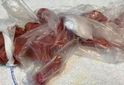 Zehra bebek, 211 günlük mücadelesinden zaferle çıktı