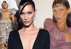 Tedavi sürecini paylaşan Bella Hadid'den 'uyuşturucu' açıklaması