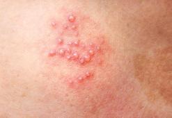 En büyük sebebi stres, sizi uykudayken yakalıyor! İşte zonanın bilinmeyen yüzü