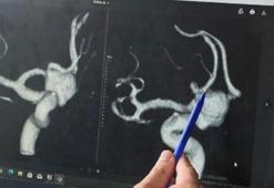 En korkulan tablo! Normal baş ağrısı gibi olmuyor... Yeni keşif