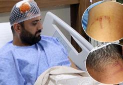 Hasta yakınlarının demir sopayla saldırdığı doktor: Canımızı zor kurtardık
