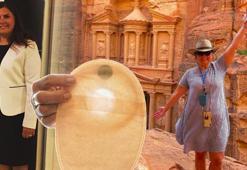 Bitmeyen karın ağrıları yaşadı, 'torba' ile tanıştı! '9 yerimden kablo çıkıyordu'