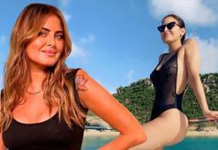 Ünlü oyuncu Silvina Luna kalça estetiği ameliyatından sonra hayatını kaybetti!