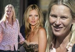 Kate Moss'un görüntüsü şaşırttı! 'Kötü alışkanlıkların kurbanı'