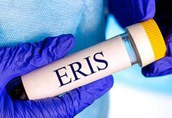 Diğer varyantlardan daha bulaşıcı! Eris bu belirtilerle geliyor