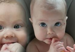 Tehlikeli diye düşünmedi! Gözleri diğer bebeklerden daha büyüktü, körlüğe neden oluyormuş