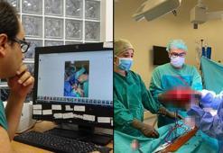 Doktorlar bile şoke oldu! Hastanın rahminden karpuz büyüklüğünde kist çıktı