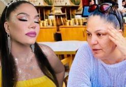 Fotoğrafına gelen yorumlara isyan etti: Yüzümdeki çukurların silinmesini istedim!