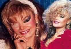 BERGEN KİMDİR? Bergen ne zaman, nasıl öldü? Bergen kaç yaşındaydı, nereli? BERGEN HAYATI