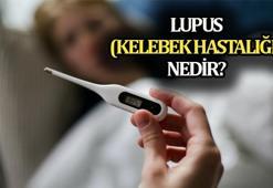 Kelebek Hastalığı (Lupus) hastalığı nedir? Kelebek hastalığı doğuştan mı, nasıl olur? Lupus belirtileri...