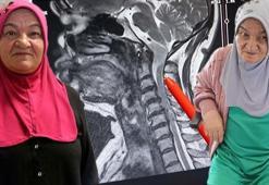 88 kilodan 54'e düştü! Hastalığının son evresinde olan gelen mucize