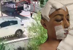 Okula giderken hayatı kabusa döndü! Yoğun bakımda 6 günlük yaşam mücadelesi