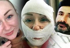 Falçatalı dehşet: Tahliye kararı verilirse öldürülecek