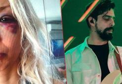 'Yüzyüzeyken Konuşuruz'un üyesi Can Tunaboylu'nun eski sevgilisinden darp iddiası!