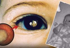 Bir gözü diğerinden parlaktı! Ailesi kameradan görünce hayatı kurtuldu