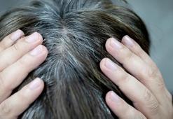 Genç yaşta saçları beyazlatan 6 neden! Önlemek mümkünmüş, sırrı burada saklı