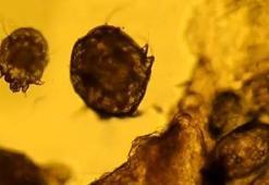 Gece kaşıntılarına dikkat! Temas ile bulaşıyor, vaka sayısı her geçen gün artıyor