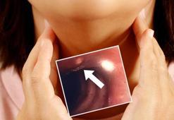 Kanlı öksürük hayatını kurtardı! 'Türkiye'de görülme sıklığı yüzde 200 arttı'