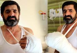 Çatı onarırken eli koptu! 4 saatlik müdahaleyle yerine dikildi