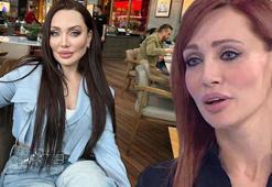 Umut Akyürek alın daraltma estetiği yaptırdı!