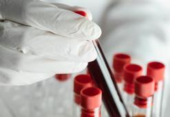 Bilim insanları, kan testinin organların hangi hızda yaşlandığını gösterebileceğini söylüyor