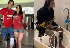 175 bin dolar ve dayanması zor bir ameliyat! Hepsi 7 cm daha uzun olabilmek için