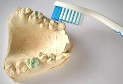 Tedavisi her yaşta mümkün! Çapraşık dişler pek çok hastalığa neden olabilir