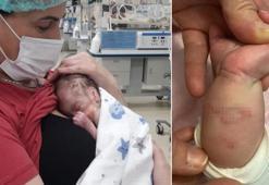 Gebze'de kan donduran iddia! Dördüz bebekler kuvözde yandı, mikrop kaparak üçü öldü