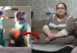 Hareket etmekte güçlük çekiyordu! Vücudundan 25 kiloluk yağ dokusu çıkarıldı