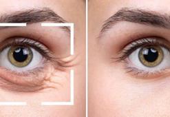 Halka halka morluklardan kurtaran yöntem! Evde yetişiyor, göz torbalarını bitiriyor