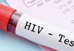 HIV teşhisinde korkutan artış
