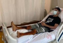 Lavabo açıcı bomba gibi patladı! 'Acı çeke çeke hastaneye gittim'