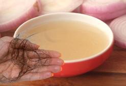 Yüzde 100 etkili sonuç! Saç dökülmesine ilaç gibi gelen yöntem, soğan bile yetiyor