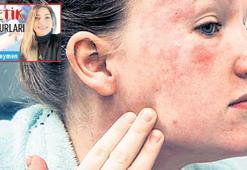 ‘Estetik mağdur’u olmak istemiyorsanız...  WhatsApp ihbar hattını arayın