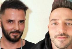 Gökhan Özen'in yüzündeki değişim dikkat çekti! 'Akıllı lens takıldı'