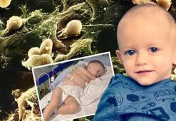 Bezdeki idrar kola rengiydi, öksürüğü geçmiyordu! Ölümcül gerçeği annesi fark etti