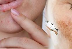 Ciltteki koyu lekelerden 2 günde kurtulun! 5 doğal malzemeden gelen mucize