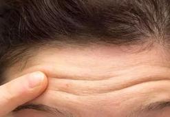 Botoks yaptırmaya gerek yok! Yaşlanmayı geciktiriyor, ince çizgileri yok ediyor