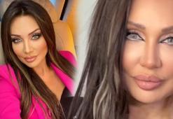 Sayısız estetik yaptıran Umut Akyürek son hali!