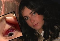 Dinlendirici gözlük için gitti, 'Kansersin' dendi! Meğer baş ağrısının sebebi buymuş