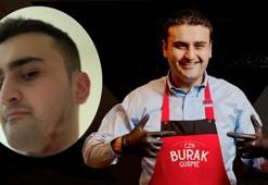 CZN Burak yaralı hallerini paylaşınca takipçilerini korkuttu!