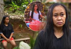 2 senede 34 yıl yaşlandı! Kırmızı lekeleri alerji sandı, sebebi ölümcül çıktı