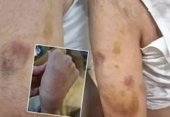Zihinsel engelli öğrenciye öğretmen şiddeti: İşkence görmüş, dayak değil