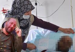 Yağmur ormanlarında yaşayanlarda görülen hastalık! Koronavirüs geçirdikten 1 sene sonra yüzü tanınmaz hale geldi