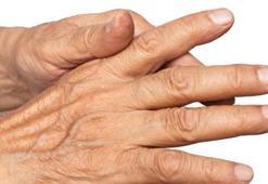 Yaşlılık belirtisi ilk ellerde başlar! Duş alırken sürüp ovalayın, hemen önlüyor