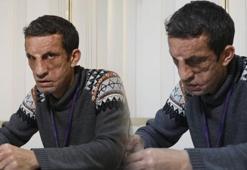 Yüz nakli ameliyatı ile yeni hayatına başlayan Uğur Acar'ın yeni hedefi