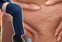 3 haftada selülitten kurtaran Çin yöntemi! Yalnızca eşarp kullanmak yetiyor