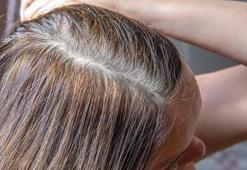 Yaşlanma saçınızı etkilemesin! Yemeklerinizden bunları eksik etmeyin