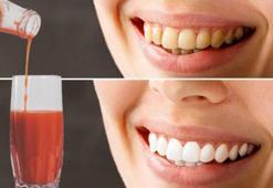 Dişçiye gitmeden inci gibi dişler! İşte evde bembeyaz yapmanın formülü